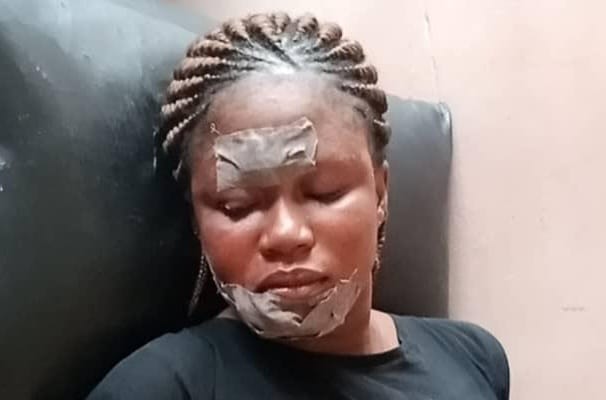 Domestic Violence: Assaulted Wife Cries For Justice